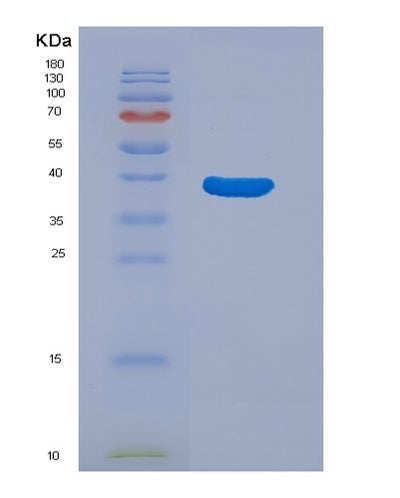 SDS-PAGE analysis of Human C3 (Complement C3) - Recombinant Protein, CAT# BLT-04069P, showing >90% purity under 15% SDS-PAGE (Reduced)Human C3 (Complement C3) - Recombinant Protein