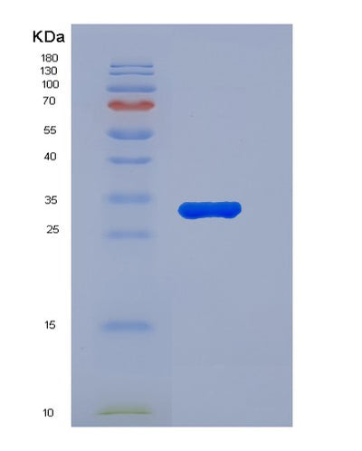 SDS-PAGE analysis of Human C5 (Complement C5) - Recombinant Protein, CAT# BLT-05029P, showing >90% purity under 15% SDS-PAGE (Reduced)Human C5 (Complement C5) - Recombinant Protein