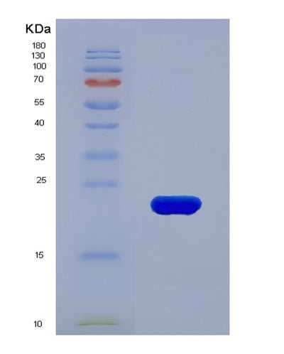 SDS-PAGE analysis of Human TIMP1 (Metalloproteinase Inhibitor 1) - Recombinant Protein, CAT# BLT-03045P, showing >90% purity under 15% SDS-PAGE (Reduced)Human TIMP1 (Metalloproteinase Inhibitor 1) - Recombinant Protein