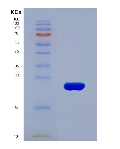 SDS-PAGE analysis of Human TIMP1 (Metalloproteinase Inhibitor 1) - Recombinant Protein, CATHuman TIMP1 (Metalloproteinase Inhibitor 1) - Recombinant Protein