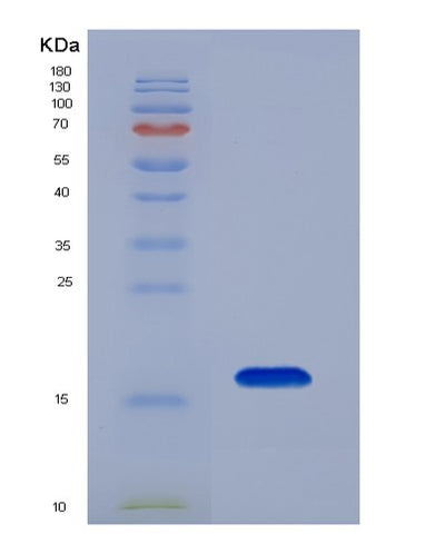 SDS-PAGE analysis of Mouse Plin4 (Perilipin-4) - Recombinant Protein, CAT# BLT-07477P, showing >90% purity under 15% SDS-PAGE (Reduced)Mouse Plin4 (Perilipin-4) - Recombinant Protein