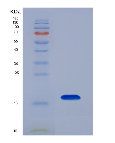 SDS-PAGE analysis of Mouse Plin4 (Perilipin-4) - Recombinant Protein, CATMouse Plin4 (Perilipin-4) - Recombinant Protein