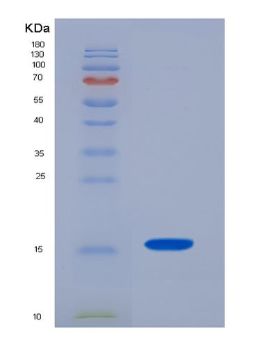 SDS-PAGE analysis of Human CST3 (Cystatin-C) - Recombinant Protein, CAT# BLT-04611P, showing >95% purity under 15% SDS-PAGE (Reduced)Human CST3 (Cystatin-C) - Recombinant Protein