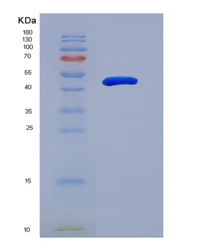 SDS-PAGE analysis of Human PRMT1 (Protein Arginine N-Methyltransferase 1) - Recombinant Protein, CAT# BLT-07478P, showing >90% purity under 15% SDS-PAGE (Reduced)Human PRMT1 (Protein Arginine N-Methyltransferase 1) - Recombinant Protein