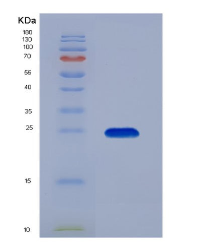 SDS-PAGE analysis of Human KRAS (Gtpase Kras) - Recombinant Protein, CAT# BLT-01660P, showing >85% purity under 15% SDS-PAGE (Reduced)Human KRAS (Gtpase Kras) - Recombinant Protein