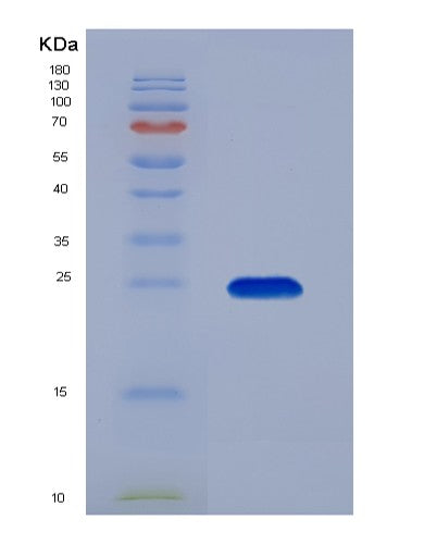SDS-PAGE analysis of Human KRAS (Gtpase Kras) - Recombinant Protein, CATHuman KRAS (Gtpase Kras) - Recombinant Protein