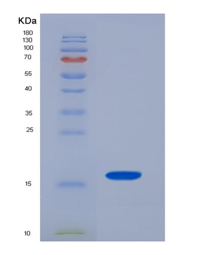 SDS-PAGE analysis of Human TSHB (Thyrotropin Subunit Beta) - Recombinant Protein, CAT# BLT-03143P, showing >85% purity under 15% SDS-PAGE (Reduced)Human TSHB (Thyrotropin Subunit Beta) - Recombinant Protein