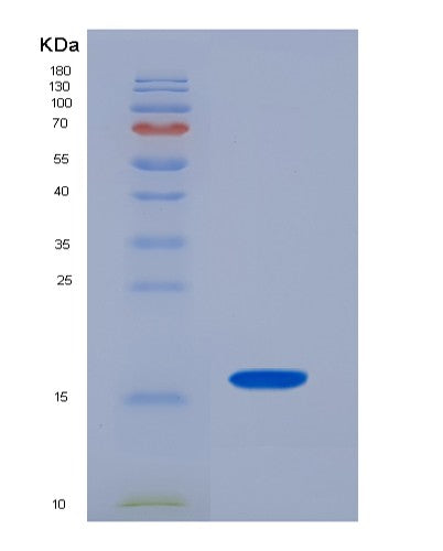 SDS-PAGE analysis of Human TSHB (Thyrotropin Subunit Beta) - Recombinant Protein, CATHuman TSHB (Thyrotropin Subunit Beta) - Recombinant Protein