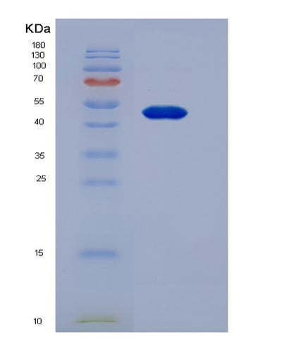 SDS-PAGE analysis of Mouse Apod (Apolipoprotein D) - Recombinant Protein, CAT# BLT-07483P, showing >90% purity under 15% SDS-PAGE (Reduced)Mouse Apod (Apolipoprotein D) - Recombinant Protein