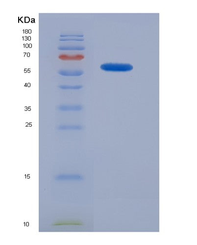 SDS-PAGE analysis of Mouse Ahr (Aryl Hydrocarbon Receptor) - Recombinant Protein, CATMouse Ahr (Aryl Hydrocarbon Receptor) - Recombinant Protein