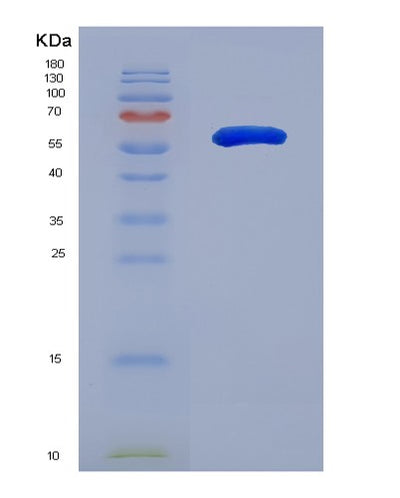 SDS-PAGE analysis of Human PADI2 (Protein-Arginine Deiminase Type-2) - Recombinant Protein, CAT# BLT-07485P, showing >90% purity under 15% SDS-PAGE (Reduced)Human PADI2 (Protein-Arginine Deiminase Type-2) - Recombinant Protein
