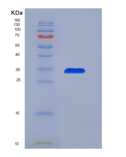 SDS-PAGE analysis of Human PADI3 (Protein-Arginine Deiminase Type-3) - Recombinant Protein, CATHuman PADI3 (Protein-Arginine Deiminase Type-3) - Recombinant Protein