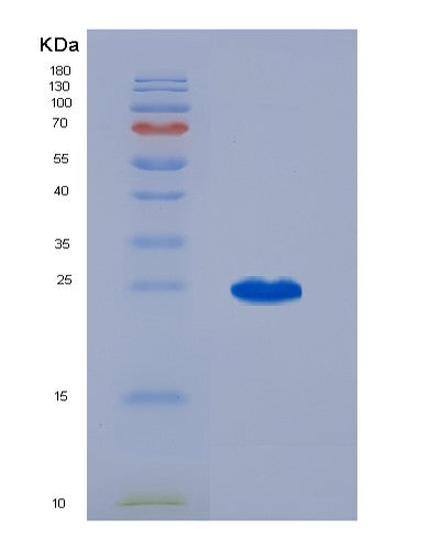 SDS-PAGE analysis of Mouse Il3 (Interleukin-3) - Recombinant Protein, CATMouse Il3 (Interleukin-3) - Recombinant Protein