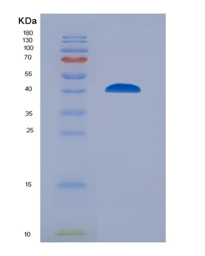 SDS-PAGE analysis of Human ACE2 (Angiotensin-Converting Enzyme 2) - Recombinant Protein, CAT# BLT-07489P, showing >90% purity under 15% SDS-PAGE (Reduced)Human ACE2 (Angiotensin-Converting Enzyme 2) - Recombinant Protein