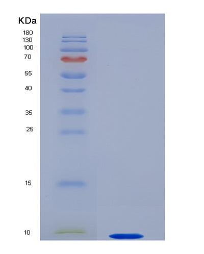 SDS-PAGE analysis of Human APOC1 (Apolipoprotein C-I) - Recombinant Protein, CAT# BLT-00187P, showing >85% purity under 15% SDS-PAGE (Reduced)Human APOC1 (Apolipoprotein C-I) - Recombinant Protein