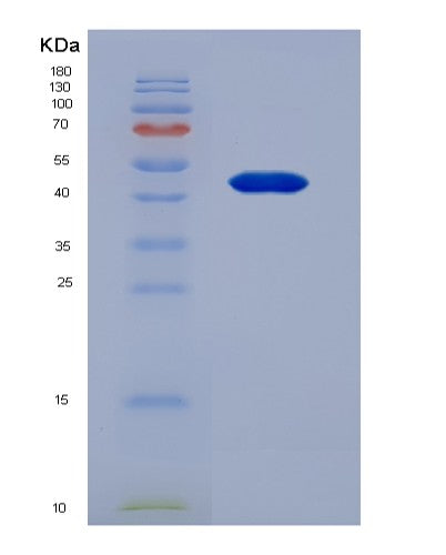 SDS-PAGE analysis of Human FGB (Fibrinogen Beta Chain) - Recombinant Protein, CATHuman FGB (Fibrinogen Beta Chain) - Recombinant Protein