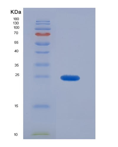 SDS-PAGE analysis of Human TJP1 (Tight Junction Protein 1) - Recombinant Protein, CAT# BLT-07490P, showing >90% purity under 15% SDS-PAGE (Reduced)Human TJP1 (Tight Junction Protein 1) - Recombinant Protein