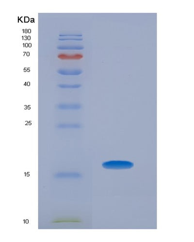 SDS-PAGE analysis of Human CRP (C-Reactive Protein) - Recombinant Protein, CAT# BLT-00698P, showing >95% purity under 15% SDS-PAGE (Reduced)Human CRP (C-Reactive Protein) - Recombinant Protein