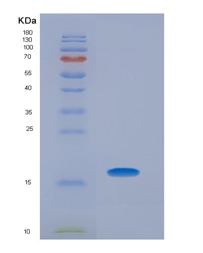 SDS-PAGE analysis of Human CRP (C-Reactive Protein) - Recombinant Protein, CATHuman CRP (C-Reactive Protein) - Recombinant Protein