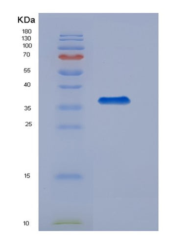 SDS-PAGE analysis of Human APOH (Beta-2-Glycoprotein 1) - Recombinant Protein, CAT# BLT-00188P, showing >95% purity under 15% SDS-PAGE (Reduced)Human APOH (Beta-2-Glycoprotein 1) - Recombinant Protein