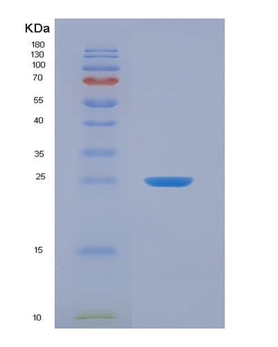 SDS-PAGE analysis of Human AMBP (Protein Ambp) - Recombinant Protein, CAT# BLT-00138P, showing >90% purity under 15% SDS-PAGE (Reduced)Human AMBP (Protein Ambp) - Recombinant Protein