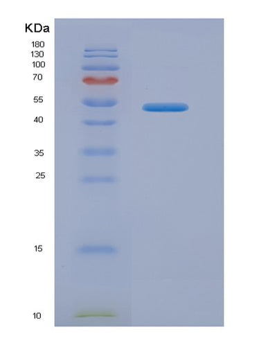 SDS-PAGE analysis of Human AMBP (Protein Ambp) - Recombinant Protein, CAT# BLT-05209P, showing >90% purity under 15% SDS-PAGE (Reduced)Human AMBP (Protein Ambp) - Recombinant Protein