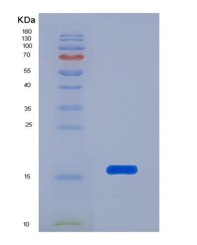 SDS-PAGE analysis of Human TTR (Transthyretin) - Recombinant Protein, CAT# BLT-02368P, showing >95% purity under 15% SDS-PAGE (Reduced)Human TTR (Transthyretin) - Recombinant Protein