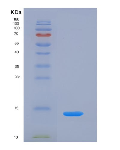 SDS-PAGE analysis of Human PPBP (Platelet Basic Protein) - Recombinant Protein, CAT# BLT-02338P, showing >85% purity under 15% SDS-PAGE (Reduced)Human PPBP (Platelet Basic Protein) - Recombinant Protein
