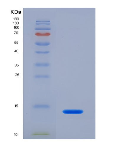 SDS-PAGE analysis of Human CXCL10 (C-X-C Motif Chemokine 10) - Recombinant Protein, CAT# BLT-03664P, showing >90% purity under 15% SDS-PAGE (Reduced)Human CXCL10 (C-X-C Motif Chemokine 10) - Recombinant Protein
