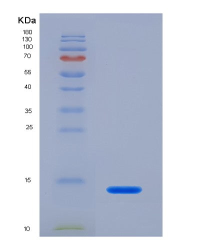 SDS-PAGE analysis of Human CXCL10 (C-X-C Motif Chemokine 10) - Recombinant Protein, CATHuman CXCL10 (C-X-C Motif Chemokine 10) - Recombinant Protein