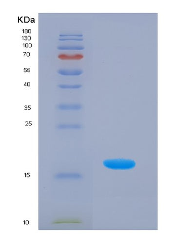 SDS-PAGE analysis of Human HPX (Hemopexin) - Recombinant Protein, CAT# BLT-01417P, showing >85% purity under 15% SDS-PAGE (Reduced)Human HPX (Hemopexin) - Recombinant Protein