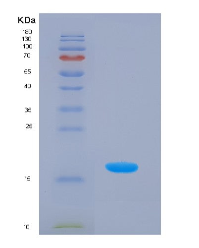 SDS-PAGE analysis of Human HPX (Hemopexin) - Recombinant Protein, CATHuman HPX (Hemopexin) - Recombinant Protein