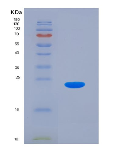 SDS-PAGE analysis of Human FTL (Ferritin Light Chain) - Recombinant Protein, CAT# BLT-01116P, showing >95% purity under 15% SDS-PAGE (Reduced)Human FTL (Ferritin Light Chain) - Recombinant Protein
