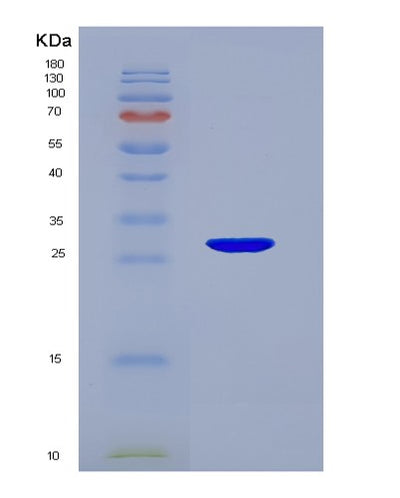 SDS-PAGE analysis of Human H1-0 (Histone H1.0) - Recombinant Protein, CAT# BLT-07492P, showing >90% purity under 15% SDS-PAGE (Reduced)Human H1-0 (Histone H1.0) - Recombinant Protein