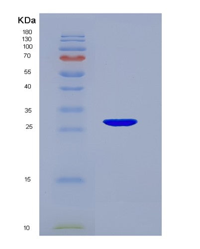 SDS-PAGE analysis of Human H1-0 (Histone H1.0) - Recombinant Protein, CATHuman H1-0 (Histone H1.0) - Recombinant Protein