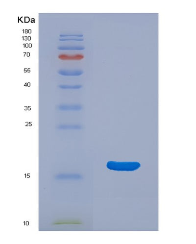 SDS-PAGE analysis of Human ANG (Angiogenin) - Recombinant Protein, CAT# BLT-03673P, showing >90% purity under 15% SDS-PAGE (Reduced)Human ANG (Angiogenin) - Recombinant Protein
