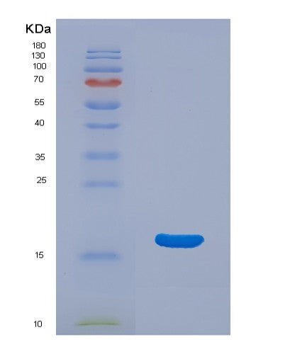 SDS-PAGE analysis of Human ANG (Angiogenin) - Recombinant Protein, CATHuman ANG (Angiogenin) - Recombinant Protein