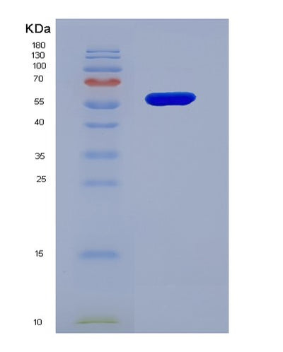 SDS-PAGE analysis of Human MMP1 (Interstitial Collagenase) - Recombinant Protein, CAT# BLT-06971P, showing >95% purity under 15% SDS-PAGE (Reduced)Human MMP1 (Interstitial Collagenase) - Recombinant Protein