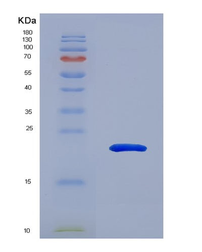 SDS-PAGE analysis of Human ATRN (Attractin) - Recombinant Protein, CAT# BLT-07493P, showing >90% purity under 15% SDS-PAGE (Reduced)Human ATRN (Attractin) - Recombinant Protein