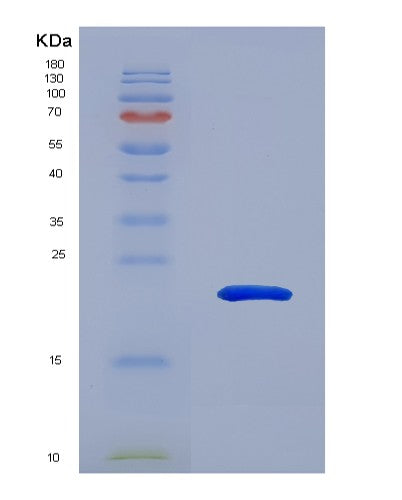 SDS-PAGE analysis of Human ATRN (Attractin) - Recombinant Protein, CATHuman ATRN (Attractin) - Recombinant Protein