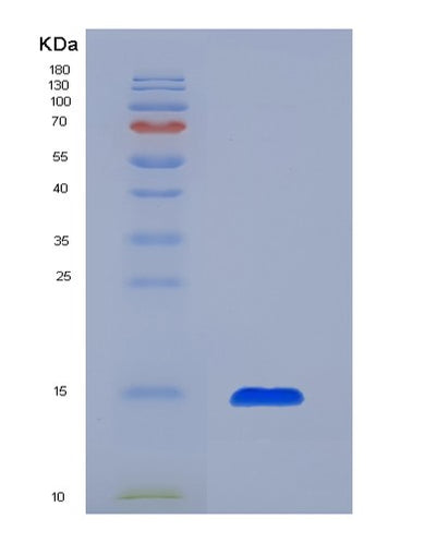 SDS-PAGE analysis of Human SLPI (Antileukoproteinase) - Recombinant Protein, CAT# BLT-02804P, showing >85% purity under 15% SDS-PAGE (Reduced)Human SLPI (Antileukoproteinase) - Recombinant Protein