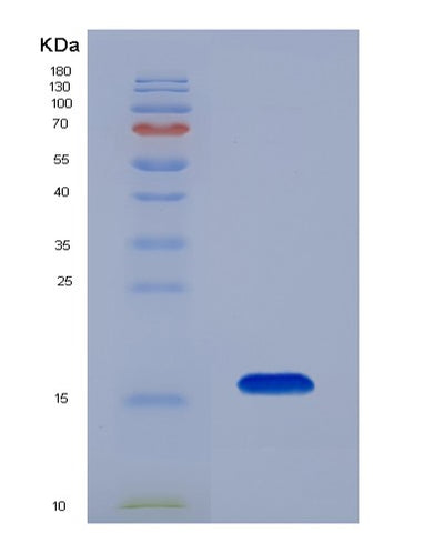 SDS-PAGE analysis of Human FABP4 (Fatty Acid-Binding Protein, Adipocyte) - Recombinant Protein, CAT# BLT-07494P, showing >90% purity under 15% SDS-PAGE (Reduced)Human FABP4 (Fatty Acid-Binding Protein, Adipocyte) - Recombinant Protein