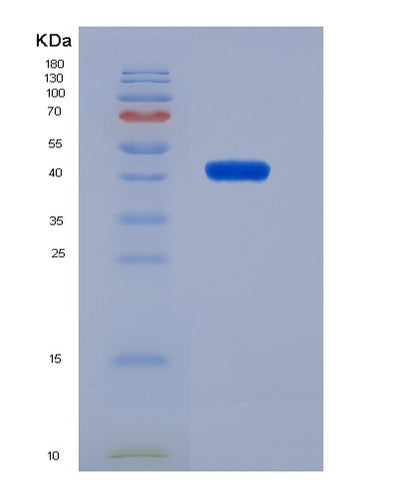SDS-PAGE analysis of Human SLC10A1 (Hepatic Sodium/Bile Acid Cotransporter) - Recombinant Protein, CAT# BLT-07495P, showing >90% purity under 15% SDS-PAGE (Reduced)Human SLC10A1 (Hepatic Sodium/Bile Acid Cotransporter) - Recombinant Protein