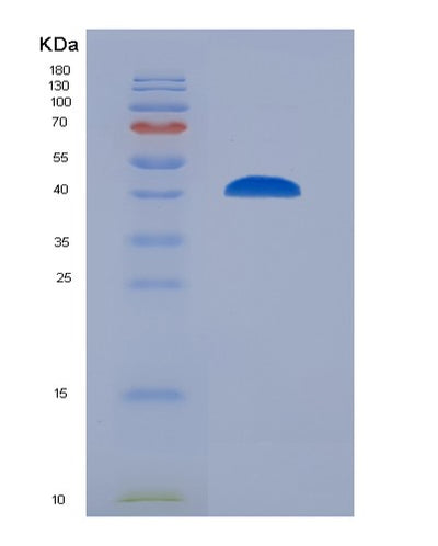 SDS-PAGE analysis of Human ANXA1 (Annexin A1) - Recombinant Protein, CAT# BLT-00159P, showing >85% purity under 15% SDS-PAGE (Reduced)Human ANXA1 (Annexin A1) - Recombinant Protein