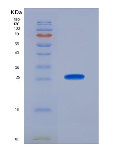 SDS-PAGE analysis of Human SOD2 (Superoxide Dismutase [Mn], Mitochondrial) - Recombinant Protein, CAT# BLT-02841P, showing >95% purity under 15% SDS-PAGE (Reduced)Human SOD2 (Superoxide Dismutase [Mn], Mitochondrial) - Recombinant Protein
