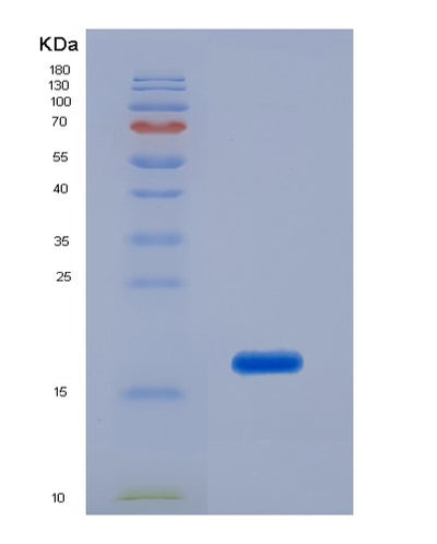 SDS-PAGE analysis of Human LCAT (Phosphatidylcholine-Sterol Acyltransferase) - Recombinant Protein, CAT# BLT-01683P, showing >85% purity under 15% SDS-PAGE (Reduced)Human LCAT (Phosphatidylcholine-Sterol Acyltransferase) - Recombinant Protein