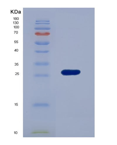 SDS-PAGE analysis of Human TNNI3 (Troponin I, Cardiac Muscle) - Recombinant Protein, CAT# BLT-07496P, showing >90% purity under 15% SDS-PAGE (Reduced)Human TNNI3 (Troponin I, Cardiac Muscle) - Recombinant Protein