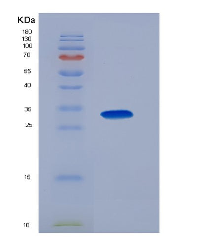 SDS-PAGE analysis of Human PAM (Peptidyl-Glycine Alpha-Amidating Monooxygenase) - Recombinant Protein, CAT# BLT-07499P, showing >90% purity under 15% SDS-PAGE (Reduced)Human PAM (Peptidyl-Glycine Alpha-Amidating Monooxygenase) - Recombinant Protein