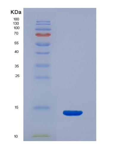 SDS-PAGE analysis of Human S100B (Protein S100-B) - Recombinant Protein, CAT# BLT-02683P, showing >85% purity under 15% SDS-PAGE (Reduced)Human S100B (Protein S100-B) - Recombinant Protein