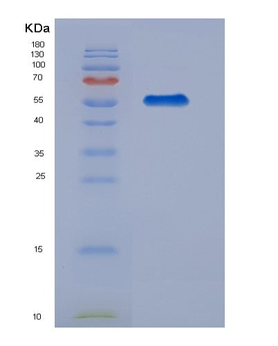 SDS-PAGE analysis of Human CAPNS1 (Calpain Small Subunit 1) - Recombinant Protein, CATHuman CAPNS1 (Calpain Small Subunit 1) - Recombinant Protein